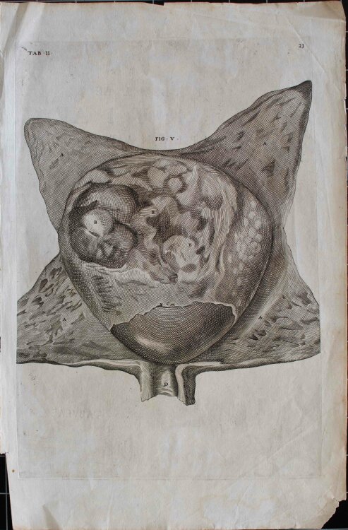 Girolamo Fabrizio - Fötus, Enzyklopädische Bildtafel - um 1600 -
